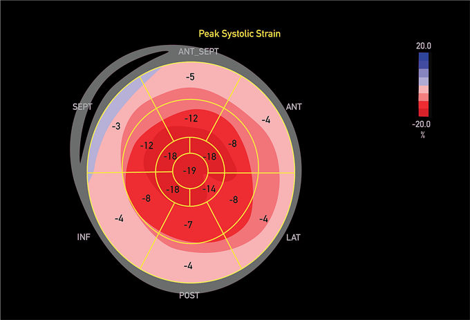 Apical